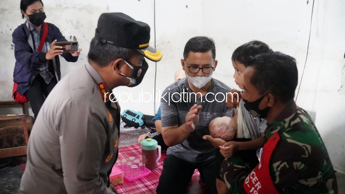 Kapolresta Sidoarjo Jenguk Bocah 5 Tahun Penderita Kelainan Usus Diluar Asal Tanggulangin